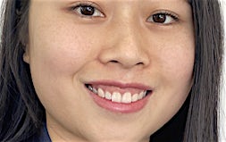 profile photo of Theresa Yeung Optometrists Lobb Optical